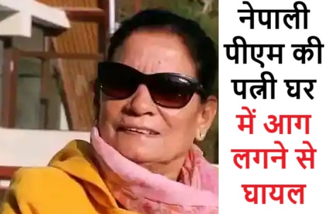 घर में आग लगने से घायल